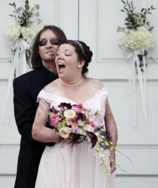 Tüm bu olanlara rağmen, hayata bağlanan ikili...