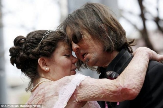 Sonbahar'da nişanlanarak, doktorlar ve hemşireler dahil, 200 davetlinin önünde evliliklerini ilan ettiler.