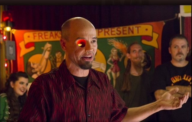 Ancak şikayetler bir türlü sona ermeyince genç adam tekrar doktora gediyor ve korkunç haberi alıyor.