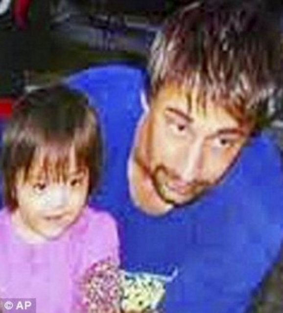 ABD'nin ilk yüz nakli yapılan insanı...  -