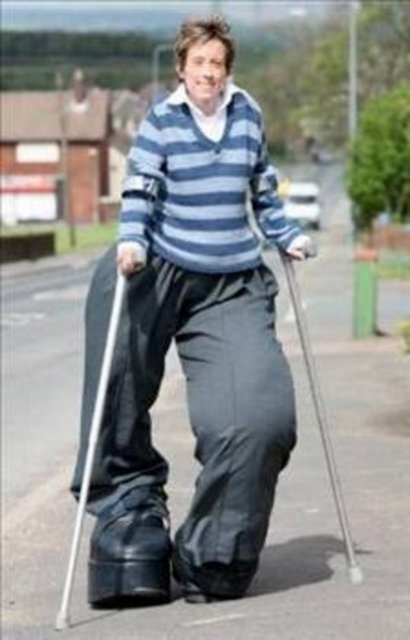 DEV BACAKLI KADIN -  - Doktorlar Mandy Sellars doğduğu andan itibaren bir şeylerin ters gittiğini anlamıştı. 34 yaşındaki kadının bacakları doğduğu günden beri şaşırtıcı bir biçimde büyüyor. Bugün bacaklarının ağırlığı 95 kilo.