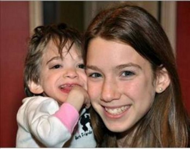 DÖRT YAŞINDA KALDI -  - 17 yaşındaki kız çocuğu Brooke'un dört yaşından beri sadece saçları ve tırnakları uzuyor. Büyüme hormonu kesinlikle etki etmiyor ve bilim adamları uzun süreden bu hastalığa çare bulmaya çalışıyor.