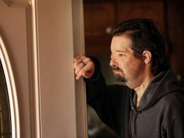 2008 yılından meydana gelen inşaat kazasında, yüksek voltaj enerji hattına dokunarak...  -