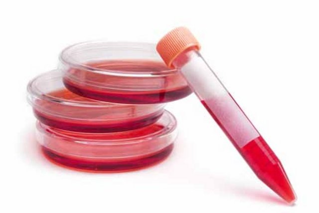 Vejetaryenler, yaşlılar, devamlı diyet yapanlar da B12 eksikliği riskiyle karşı karşıyadır.