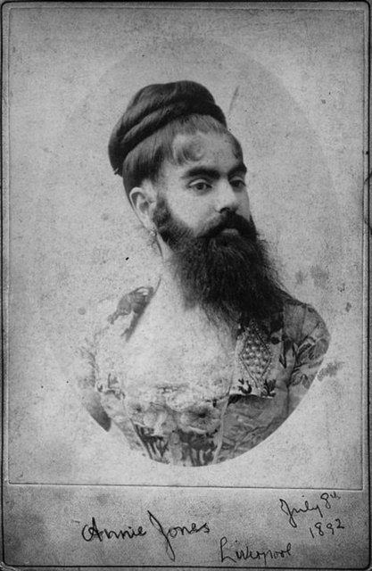Hirsutizm hastalığı ile doğan Annie Jones, Rusya'da şov için gezdiği sıralarda onun Hz. İsa gibi poz vermesini istediler ancak o geri çevirdi. 1902 yılında da tüberkülozdan hayatını kaybetti.