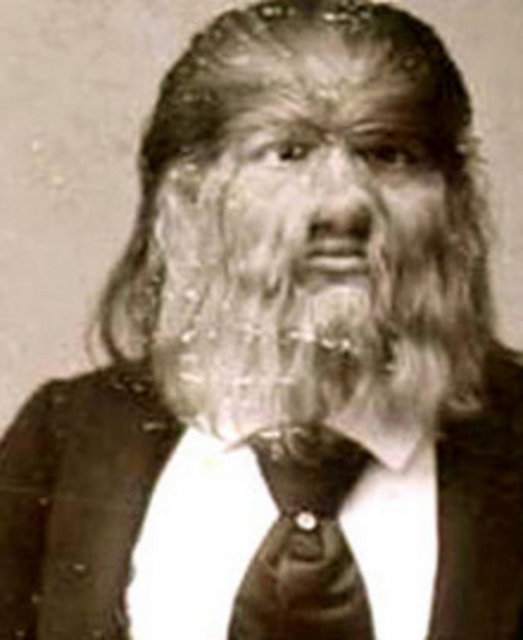 Jo Jo Köpek Yüzlü Çocuk olarak tanındı. 16 yaşından itibaren PT Barnum ile çalışan Fedor, dünya çağında üne ve servete kavuştu.