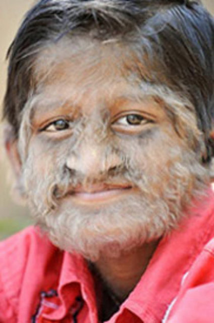 Ailesi tedavi ettirebilmek için her yolu denemiş ancak hiçbir sonuç alamamışlar.