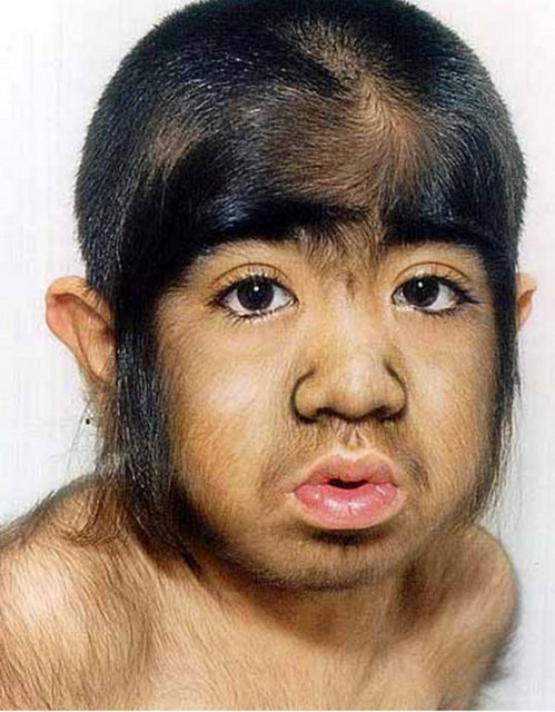 Yu Zhenhuan: 1979 yılında Çin'in Anshan şehrinde dünyaya gelen Yu Zhenhuan'ın vücudunun yüzde 96′sı kıllarla kaplı.