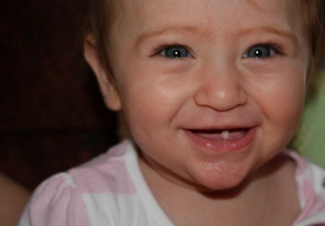 Her bin bebekten biri tek dişle doğuyor