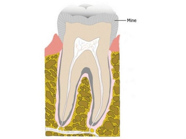 Diş minesi insan vücudundaki en sert madde