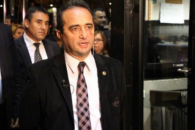 Hastane çıkışı açıklama yapan Tezcan, "Türkiye'de demokrasi ve hukuku savunmak konusunda kararlılık gösterilmesi gerektiğine inanıyoruz.