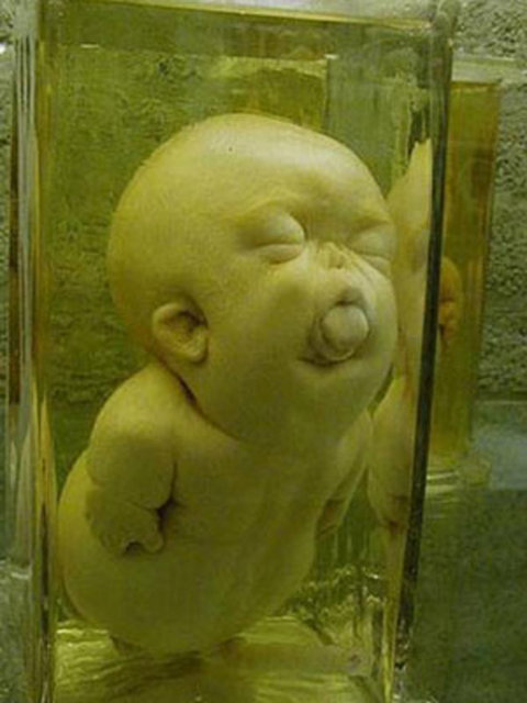 DÜNYANIN EN KORKUNÇ MÜZESİ - Mutter Müzesi'nde pek çok tıbbi tuhaflık sergileniyor. Müze geniş kafatası ve iskelet koleksiyonuyla ünlü...