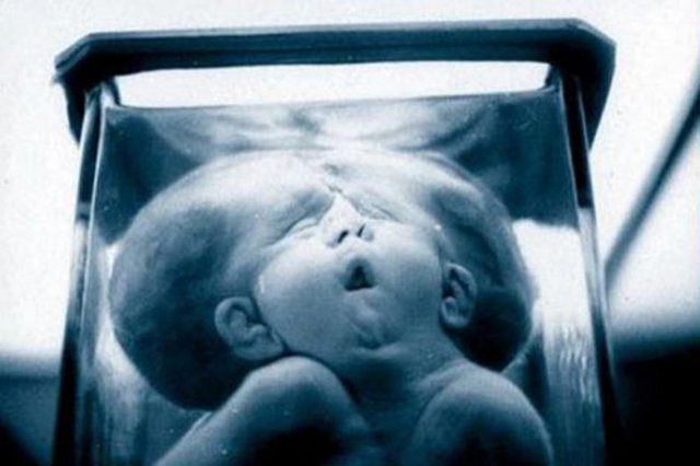 Müzenin en nadide parçası ise gömüldüğü yerde sabuna dönüşen bir kadın cesedi ve 2 kafalı bir çocuk iskeleti...