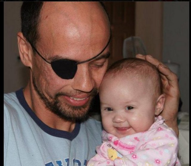 Amerikalı  eski bir motosiklet ustası olan  Billy Owen'ın hayatı 2009 yılında hayatının belki de en korkunç haberini aldı. -