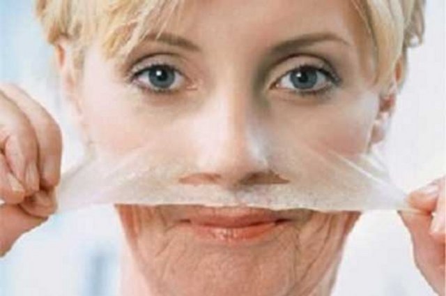 Diğer bir tedavi yöntemi BBL "skin rejuvenation". Yani lazer ile cildi yenileme işlemi.