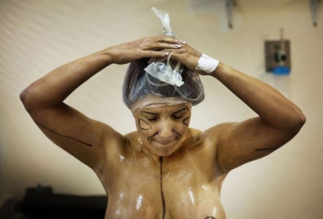 O anlarının görüntülenmesini istedi - Kolombiya'da estetik ameliyatını kare kare görüntülettiren Brenda Fuentes adındaki kadın, estetik yaptırmak isteyenleri adeta vazgeçirtecek.