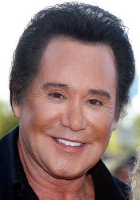 Wayne Newton en çok botoks yaptıran ünlülerden biri.