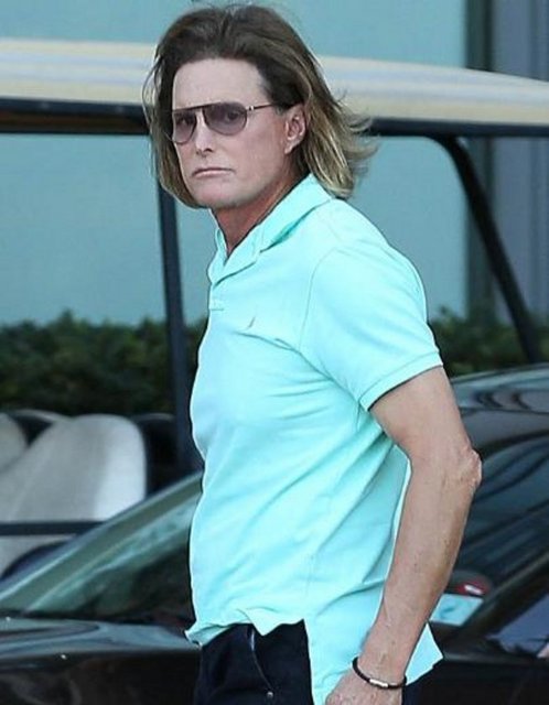Bruce Jenner da botoks bağımlısı. Geçenlerde Adem elmasını bile küçültürdü.