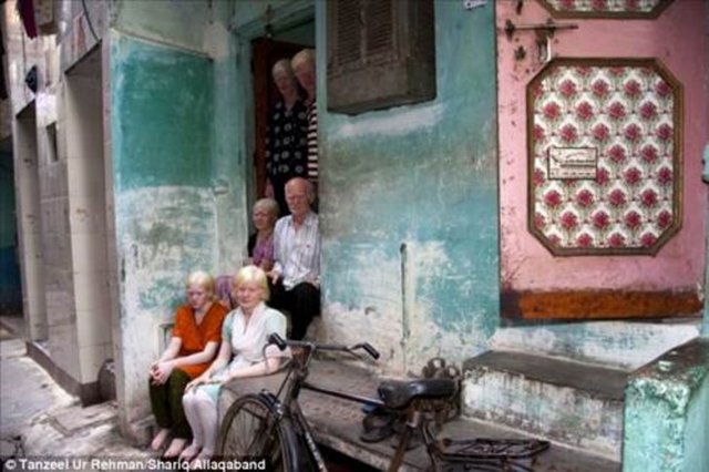 Bu özellikleriyle Guinness rekorlar kitabı'nda kendilerine yer buldular. Albinoluk 17.000'de 1 görülen bir rahatsızlık Tüm bireylerin Albino olması Pullan ailesini özel kılıyor...