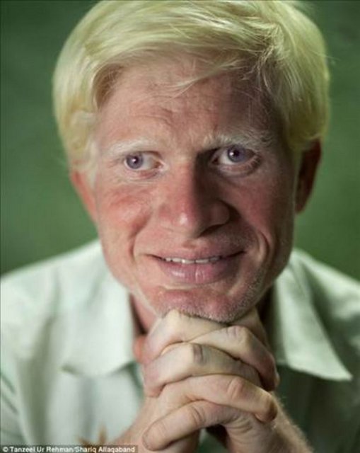 Kendilerini hasta değil özel hissettiklerini söylüyorlar.