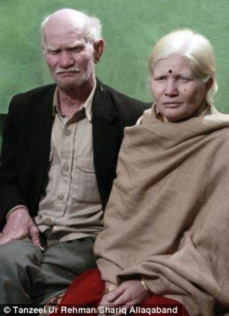 Ailenin büyükleri Roseturai ve Mani, "Hindistan'da bir inanışa göre albinoların birbiriyle evlenmesi şans ve zenginlik getirir...