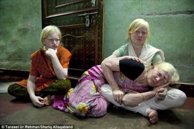 Aksine, kendilerine gösterilen ilgiden olukça memnunlar. Guinness sayesinde elde ettikleri şöhret Pullan Ailesini mutlu ediyor...