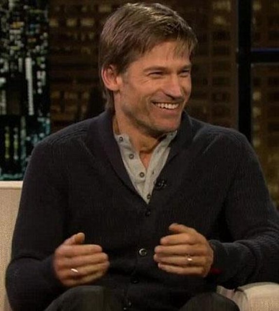 Sahneden sonra çektiği morluk fotoğraflarını da gösteren 43 yaşındaki aktör, programının sunucusundan "Aman Tanrım" tepkisi aldı.