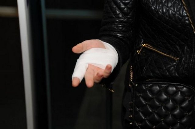 "Kapıyı aralayınca elim kapıya sıkıştı."