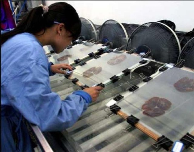 İnsanların kendi vücutlarını bağışlamaları sonucu insan bedenlerinin ve iç organlarının halka sergilenebildiği tek insan anatomisi sergisi Gunther von Hagens' Body Worlds dur...