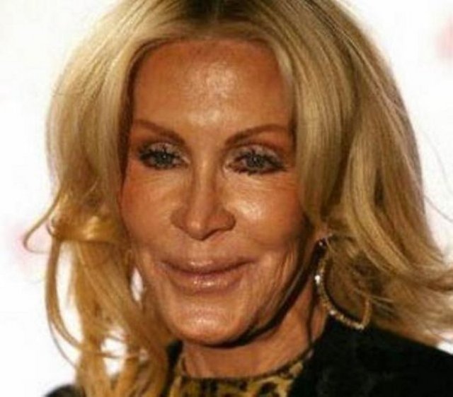 Joan Van Ark'ın yüzü de böyle tuhaf bir hale geldi.