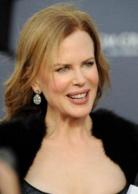 Nicole Kidman bile yüzüne botoks yaptırdığını itiraf etti.
