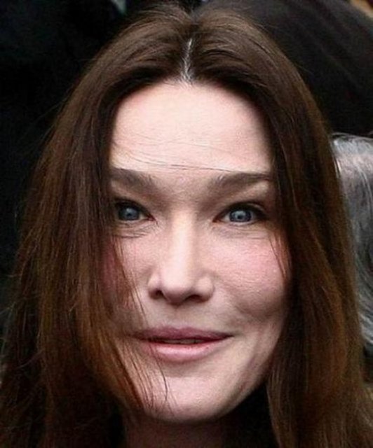 Carla Bruni'nin botokslu görüntüsü.