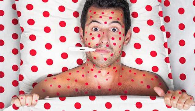 Kızamık, kızamıkçık, kabakulak çok ciddi hastalıklar. Bu hastalıklara bağlı olarak gelişen zatürre, menenjit, körlük, sağırlık, doğumsal anormallikler hem çocukluk hem de erişkinlik döneminin ağır sonuçları olarak karşımıza geçmiş dönemerde çıktı!