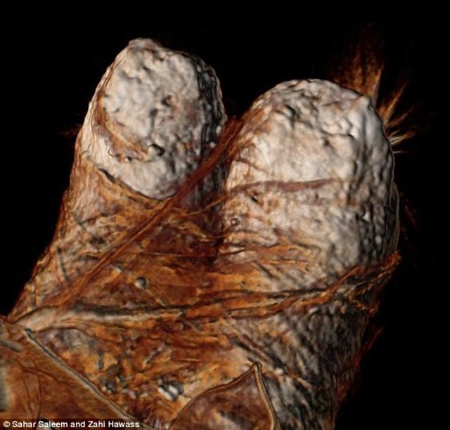 Yeni bulgular bu suikastin nasıl yapıldığını ortaya çıkardı.