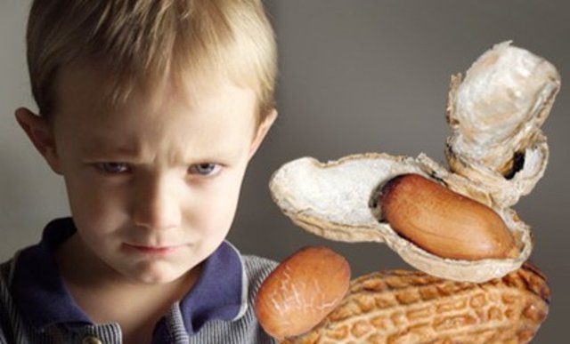 Time'ın haberine göre 1997 ile 2002 yılları arasında, çocuklarda, yer fıstığı alerjisinin görülme sıklığı iki katına çıktı.