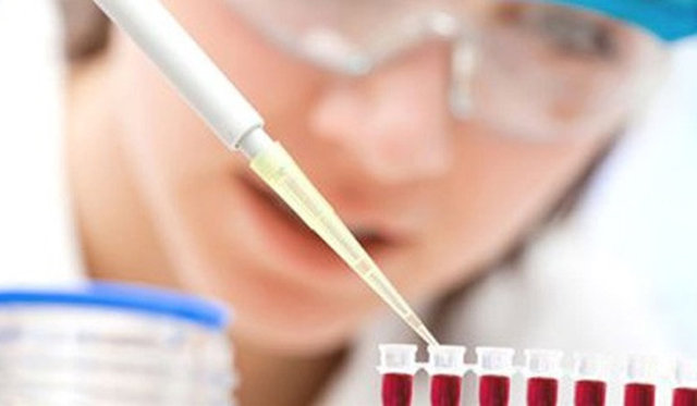 YÜKSEK KOLESTROL: Vücut susuz kaldığında kolestrol seviyesini arttırarak hücreden daha fazla su kaybını önlemeye çalışır. -