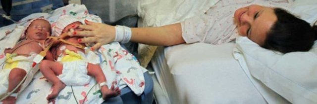 Dünyada ender görülen, tek rahimde birbirleriyle yakın temas içinde olmasından dolayı "mono mono" olarak adlandırılan ikizlerin, cuma günü 33 haftalık olarak doğduğu ve sağlık durumlarının iyi olduğu öğrenildi.
