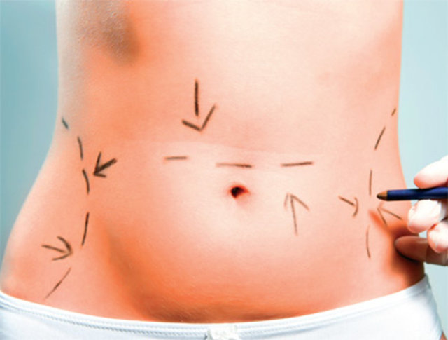 Yediğiniz ve içtiğiniz gıdalar hakkında bilgi sahibi olmanız önemlidir çünkü tükettiğiniz gıdaların içeriğinde size kendinizi daha şişkin hissettirecek bileşenler bulunuyor olabilir.  -