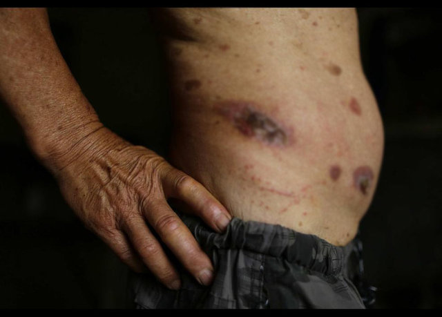 Gong'un vücudundaki yaralar tehlikeli boyutlarda.