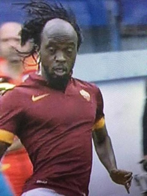 Başının ön tarafının kel olması nedeniyle saç bandı takan Romalı futbolcu Gervinho, maç sırasında bandını düşünce ortaya ilginç bir görüntü çıktı.
