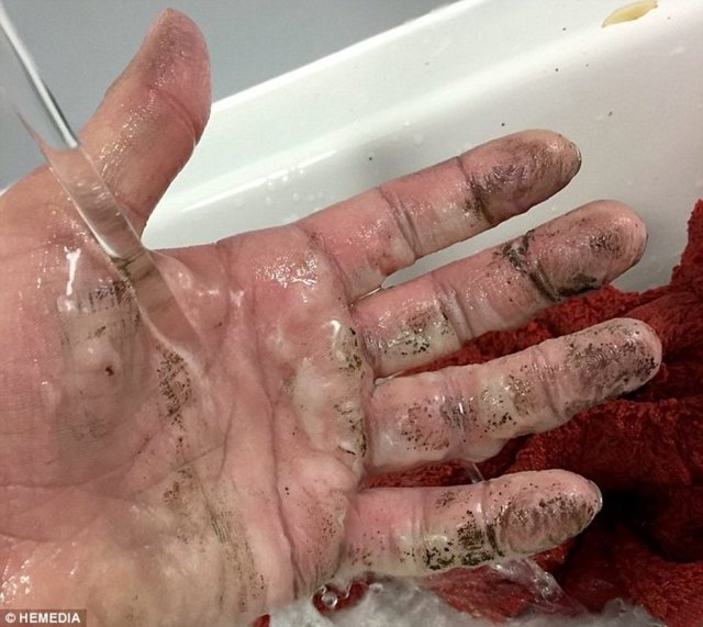 Telefonunu dizüstü bilgisayarında şarj etmek isteyen Katy Emslie'ın telefonu bir anda havai fişek gibi patladı. Bu patlama sonucu Emslie'ın eli ciddi derecede yandı!  -