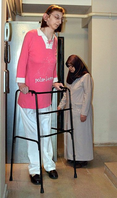 Omurilik ameliyatından sonra hayallerimin gerçekleşme imkanının olabileceğini fark ettim. Daha önce bunların hepsi hayaldi, şimdi biraz daha gerçeğe yakın. Bu ameliyatın benim için hayati önemi vardı, hayallerim için çok önemliydi...