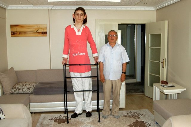 "Kızımın tedavisi için belli bir boya ulaşması beklendi. 6 yaşına geldiğinde boyu 1 metre 76 santimetreydi. Ağırlığı da 65 kilo civarındaydı. Kontrolsüz büyüyen boyu için için ilaç tedavisi başladı...