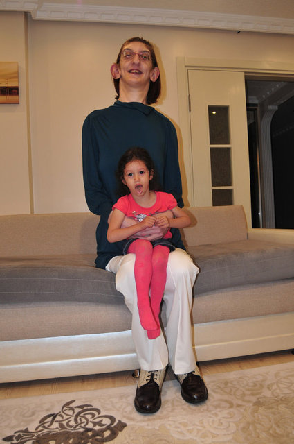 Rümeysa'da birçok ilklerin yaşandığını belirten anne Gelgi, "Sendromu açısından Rümeysa'nın kalp amilyatı dünyanın ilk ameliyatı.