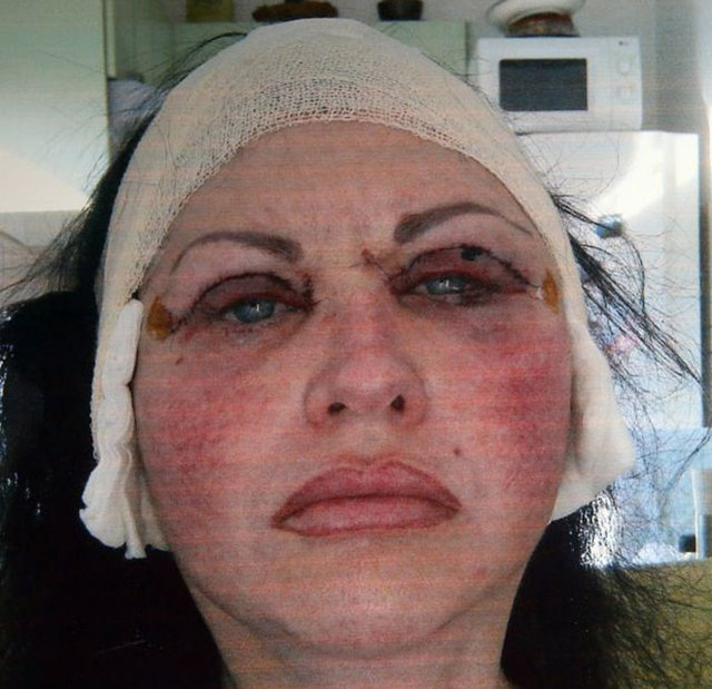 Kaş, dudak ve göz çevresi kalıcı makyaj: 5,400 TL