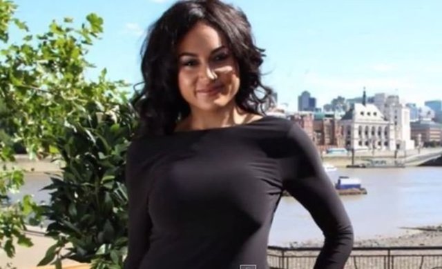 Operasyonlardan önce çok çirkin olduğunu ifade eden Claire Lesson, 'Birkaç arkadaşım Kim Kardashian'a benzediğimi söyleyince çok mutlu oldum.