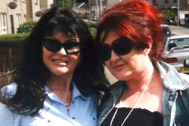 Yüz kaldırma:4,680 TL