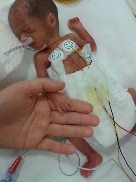 5.5 ay sonra bebeğine kavuşan anne Çakır, "Bu bir mucize, rabbimin bir armağanı" dedi