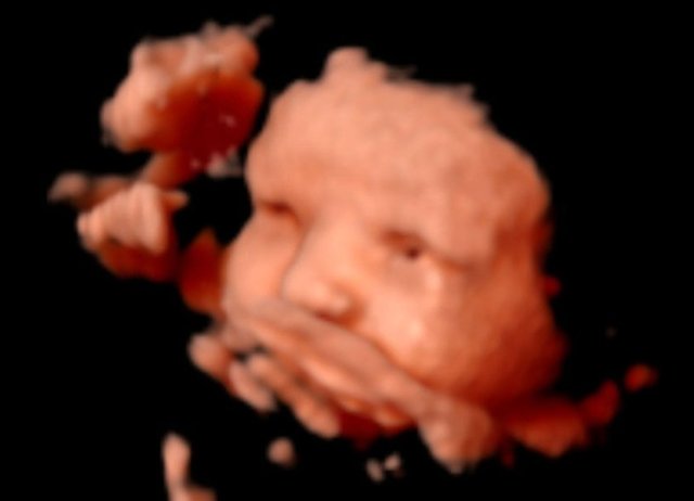 İşte mucizenin fotoğrafları...