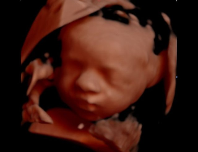 Operatör Dr. Alaattin Kaçar, ailelerin artık, fotoğraf albümü oluşturmak için doğumu beklemeden anne karnında başladığını söyledi.